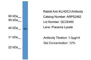 Image no. 2 for anti-Kelch Domain Containing 3 (KLHDC3) (N-Term) antibody (ABIN2784950)
