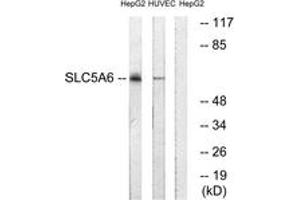 Image no. 1 for anti-Solute Carrier Family 5 (Iodide Transporter), Member 6 (SLC5A6) (AA 551-600) antibody (ABIN1535388)