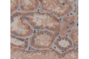 Image no. 2 for anti-Interleukin 21 Receptor (IL21R) (AA 23-185) antibody (ABIN1868630)