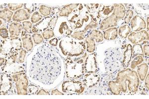 Immunohistochemical analysis of paraffin-embedded Human kidney section using Pink1 (ABIN1538954 and ABIN2849886).