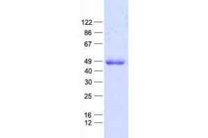 E2F5 Protein (E2F5) (His tag)