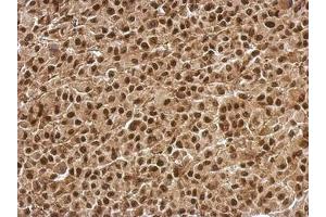 anti-B-Cell CLL/lymphoma 7C (BCL7C) (AA 1-215) antibody
