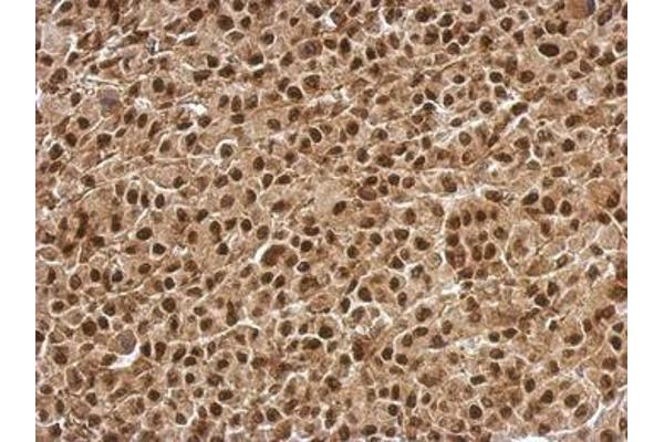 anti-B-Cell CLL/lymphoma 7C (BCL7C) (AA 1-215) antibody