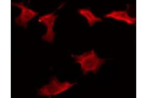 Image no. 2 for anti-CD160 (CD160) (Internal Region) antibody (ABIN6257994)