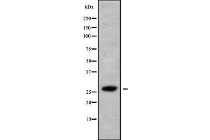 Image no. 2 for anti-HAUS Augmin-Like Complex, Subunit 2 (HAUS2) (N-Term) antibody (ABIN6260767)
