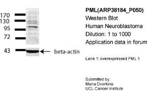 Image no. 2 for anti-Promyelocytic Leukemia (PML) (Middle Region) antibody (ABIN2778427)