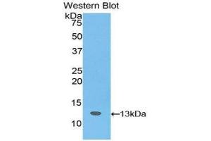 anti-Slit Homolog 3 (SLIT3) (AA 62-119) antibody