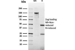 Image no. 1 for anti-Thrombomodulin (THBD) (AA 69-194) antibody (ABIN6940729)