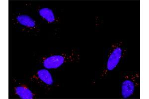 Image no. 3 for anti-Fibroblast Growth Factor Receptor 1 (FGFR1) (AA 31-150) antibody (ABIN560872)