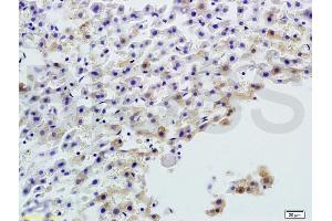 Image no. 2 for anti-Alkaline Phosphatase, Liver/bone/kidney (ALPL) (AA 52-150) antibody (ABIN730988)