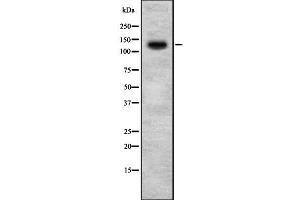 Image no. 1 for anti-Homeodomain Interacting Protein Kinase 2 (HIPK2) (N-Term) antibody (ABIN6262242)
