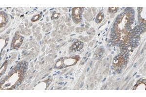 Image no. 2 for anti-Eukaryotic Translation Initiation Factor 4A1 (EIF4A1) (N-Term) antibody (ABIN6261486)