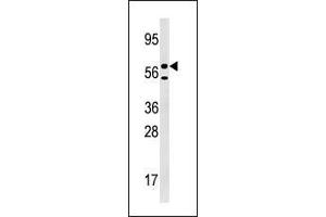 Image no. 2 for anti-Uridine-Cytidine Kinase 1-Like 1 (UCKL1) (N-Term) antibody (ABIN359378)