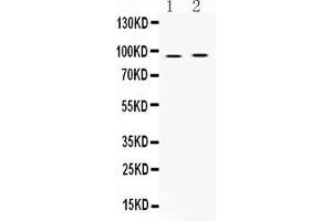 Image no. 1 for anti-A Kinase (PRKA) Anchor Protein 2 (AKAP2) (AA 813-852), (C-Term) antibody (ABIN5518729)