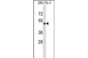 ZSCAN18 Antibody (Center) (ABIN1538026 and ABIN2849458) western blot analysis in ZR-75-1 cell line lysates (35 μg/lane).