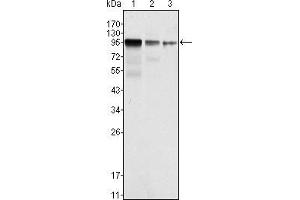 Image no. 3 for anti-FER Tyrosine Kinase (FER) antibody (ABIN969133)
