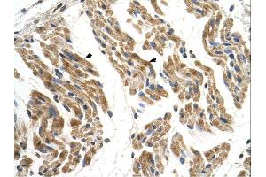 Image no. 2 for anti-Solute Carrier Family 35, Member F2 (SLC35F2) (N-Term) antibody (ABIN2781651)