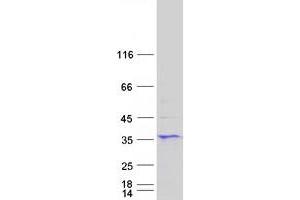 Image no. 1 for Six Transmembrane Epithelial Antigen of The Prostate 1 (STEAP1) protein (Myc-DYKDDDDK Tag) (ABIN2732839)