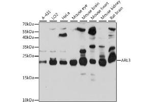 ARL3 anticorps  (AA 1-182)