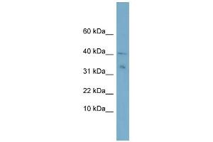 Image no. 1 for anti-NADH Dehydrogenase (Ubiquinone) Flavoprotein 3, 10kDa (NDUFV3) (Middle Region) antibody (ABIN2782353)