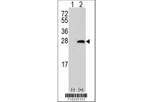 Image no. 1 for anti-sigma Non-Opioid Intracellular Receptor 1 (SIGMAR1) (AA 118-147) antibody (ABIN389222)