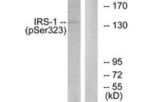 Western blot analysis of extracts from COS7 cells treated with Serum 20% 15', using IRS-1 (Phospho-Ser323) Antibody.