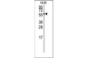 Image no. 1 for anti-Cytochrome P450, Family 4, Subfamily Z, Polypeptide 1 (CYP4Z1) (N-Term) antibody (ABIN360253)