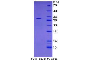 Image no. 1 for CD302 (CD302) (AA 23-232) protein (His tag) (ABIN1879495)