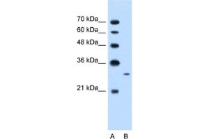 Image no. 1 for anti-MAP3K7 C-Terminal Like (MAP3K7CL) antibody (ABIN2462602)