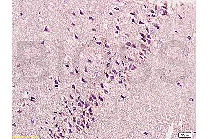 Image no. 2 for anti-Fibroblast Growth Factor 2 (Basic) (FGF2) (AA 143-250) antibody (ABIN726425)
