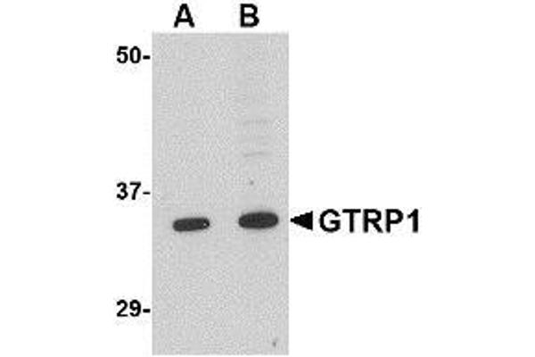 GRTP1 Antikörper  (N-Term)