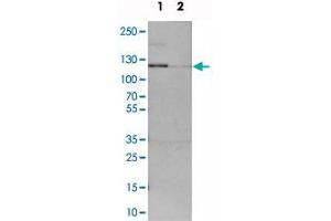 Image no. 3 for anti-ADNP Homeobox 2 (ADNP2) antibody (ABIN5572097)
