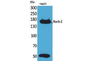 Image no. 1 for anti-rho-Associated, Coiled-Coil Containing Protein Kinase 2 (ROCK2) (Internal Region) antibody (ABIN3187730)