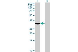 Image no. 2 for anti-Methyl-CpG Binding Domain Protein 3 (MBD3) (AA 1-291) antibody (ABIN526975)