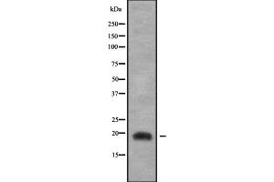 Image no. 1 for anti-Jun Dimerization Protein 2 (JDP2) (C-Term) antibody (ABIN6262706)