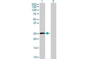 Image no. 1 for anti-Interleukin 27 (IL27) (AA 1-243) antibody (ABIN531417)