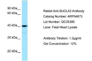 Image no. 1 for anti-Succinate-CoA Ligase, ADP-Forming, beta Subunit (SUCLA2) (C-Term) antibody (ABIN2789919)