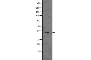 Image no. 1 for anti-Natural Cytotoxicity Triggering Receptor 1 (NCR1) antibody (ABIN6263643)