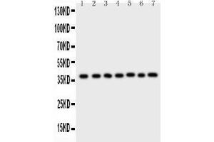 Image no. 1 for anti-Aryl Hydrocarbon Receptor Interacting Protein (AIP) (AA 91-330) antibody (ABIN3043728)