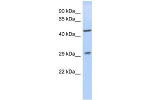 Image no. 1 for anti-Lix1 Homolog (LIX1) antibody (ABIN632169)