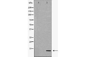 Image no. 2 for anti-S100 Calcium Binding Protein A4 (S100A4) (C-Term) antibody (ABIN6264903)