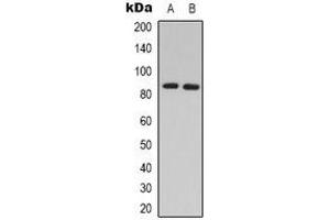 Image no. 1 for anti-Adrenergic, Beta, Receptor Kinase 2 (ADRBK2) antibody (ABIN2957593)