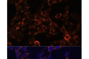 Immunofluorescence analysis of NIH-3T3 cells using USE1 Polyclonal Antibody at dilution of 1:100 (40x lens).