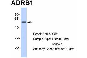 Image no. 4 for anti-Adrenergic, beta-1-, Receptor (ADRB1) (Middle Region) antibody (ABIN2774823)