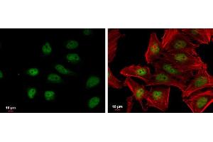 Image no. 2 for anti-Nuclear Factor (erythroid-Derived 2)-Like 2 (NFE2L2) (Internal Region) antibody (ABIN2855612)