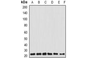 Image no. 1 for anti-Transgelin 2 (TAGLN2) (full length) antibody (ABIN6005460)