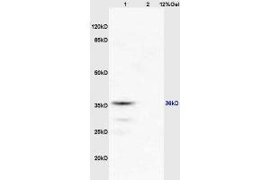 Image no. 2 for anti-Ras Association (RalGDS/AF-6) Domain Family Member 2 (RASSF2) (AA 201-300) antibody (ABIN681988)