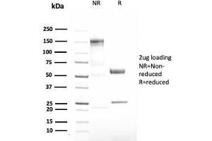 Image no. 1 for anti-serpin Peptidase Inhibitor, Clade A (Alpha-1 Antiproteinase, Antitrypsin), Member 1 (SERPINA1) antibody (ABIN6940314)