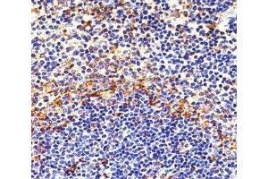 Image no. 3 for anti-FYN Oncogene Related To SRC, FGR, YES (FYN) antibody (ABIN3031012)