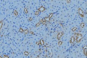 Image no. 1 for anti-Mitochondrial Ribosomal Protein L34 (MRPL34) (Internal Region) antibody (ABIN6263369)